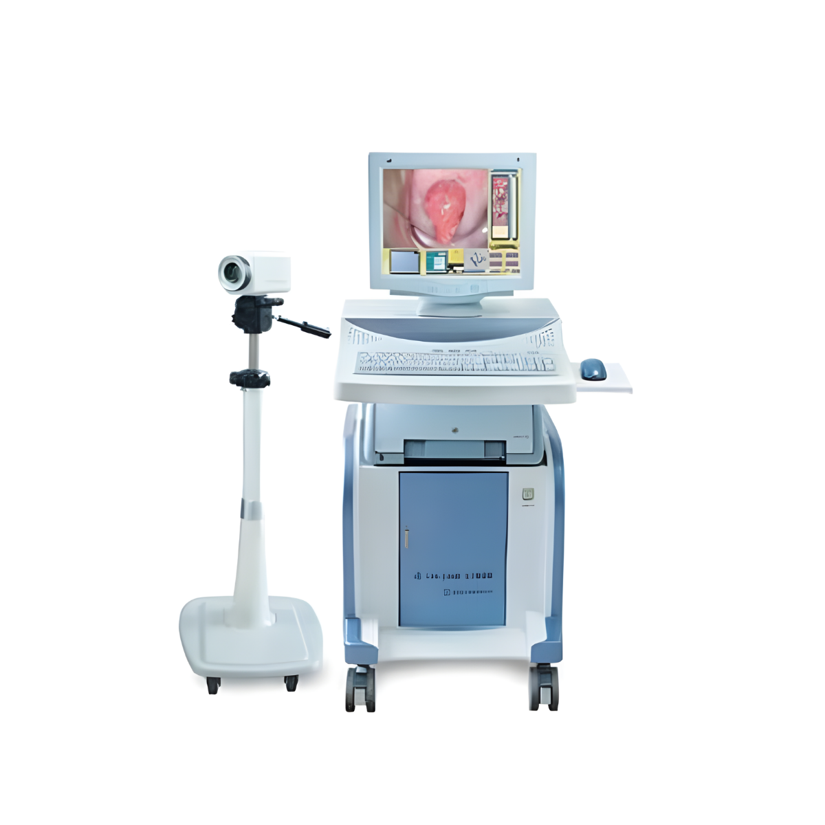 MÁY NỘI SOI CỔ TỬ CUNG