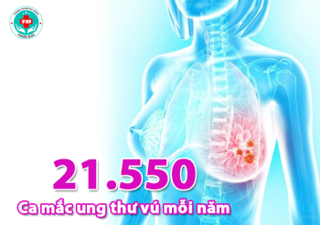 CẢNH BÁO: Ung thư vú có tỷ lệ mắc cao nhất trong các loại bệnh ung thư ở nữ giới