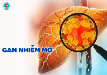 Bệnh gan nhiễm mỡ có nguy hiểm không?