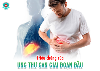 Triệu chứng của ung thư gan giai đoạn đầu