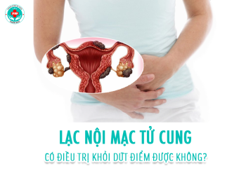 Lạc nội mạc tử cung có điều trị khỏi hoàn toàn được không?