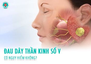 Đau dây thần kinh số V có nguy hiểm không?