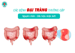 Các Bệnh Đại Tràng Thường Gặp: Dấu Hiệu Nhận Biết Và Cách Phòng Ngừa