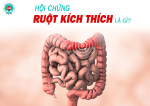 Hội Chứng Ruột Kích Thích: Nguyên Nhân, Triệu Chứng Và Cách Kiểm Soát Hiệu Quả