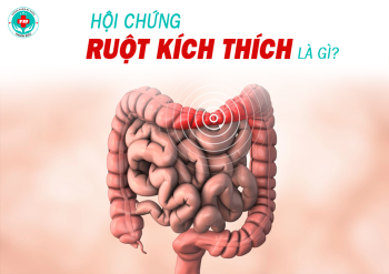 Hội Chứng Ruột Kích Thích: Nguyên Nhân, Triệu Chứng Và Cách Kiểm Soát Hiệu Quả