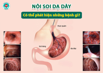Những bệnh lý có thể được chẩn đoán nhờ nội soi dạ dày