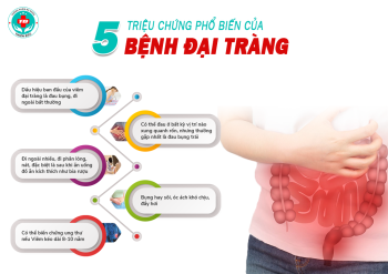 Triệu Chứng Bệnh Đại Tràng: Những Dấu Hiệu Cảnh Báo Không Nên Chủ Quan