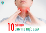 10 Dấu hiệu cảnh báo sớm có thể bạn đang bị ung thư thực quản