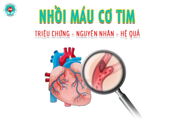 Nhồi máu có tim - Triệu chứng, nguyên nhân và hệ quả để lại