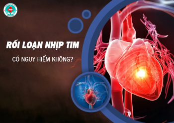 Bệnh rối loạn nhịp tim có nguy hiểm không?